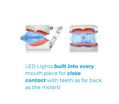 PearlySmile | Mobile Teeth Whitening Kit (15 Treatments)